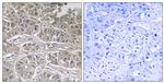 SLC25A21 Antibody in Immunohistochemistry (Paraffin) (IHC (P))