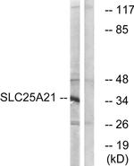 SLC25A21 Antibody in Western Blot (WB)