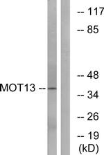 SLC16A13 Antibody in Western Blot (WB)