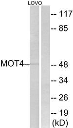 SLC16A3 Antibody in Western Blot (WB)