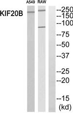 MPHOSPH1 Antibody in Western Blot (WB)
