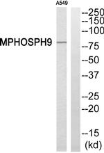 MPP9 Antibody in Western Blot (WB)