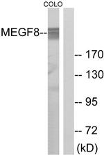 EGFL4 Antibody in Western Blot (WB)