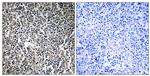 MPRIP Antibody in Immunohistochemistry (Paraffin) (IHC (P))