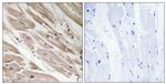 MYBPC3 Antibody in Immunohistochemistry (Paraffin) (IHC (P))
