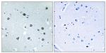 MYO1D Antibody in Immunohistochemistry (Paraffin) (IHC (P))