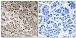 NDUFB1 Antibody in Immunohistochemistry (Paraffin) (IHC (P))