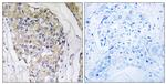 NDUFS6 Antibody in Immunohistochemistry (Paraffin) (IHC (P))