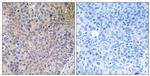 NDUFS7 Antibody in Immunohistochemistry (Paraffin) (IHC (P))