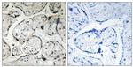 CYB5R3 Antibody in Immunohistochemistry (Paraffin) (IHC (P))