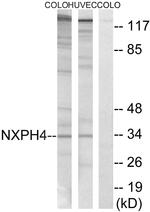 NXPH4 Antibody in Western Blot (WB)