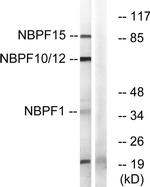 NBPF Pan Antibody in Western Blot (WB)