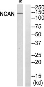 Neurocan Antibody in Western Blot (WB)