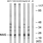 NMS Antibody in Western Blot (WB)