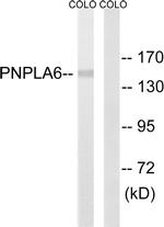 NTE Antibody in Western Blot (WB)