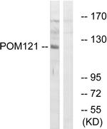POM121 Antibody in Western Blot (WB)