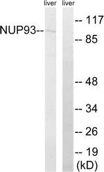 NUP93 Antibody in Western Blot (WB)