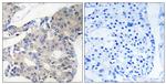 NCOA4 Antibody in Immunohistochemistry (Paraffin) (IHC (P))