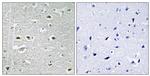 URB1 Antibody in Immunohistochemistry (Paraffin) (IHC (P))