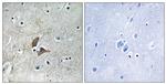 OMG Antibody in Immunohistochemistry (Paraffin) (IHC (P))