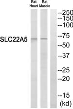 SLC22A5 Antibody in Western Blot (WB)