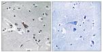 SLC6A16 Antibody in Immunohistochemistry (Paraffin) (IHC (P))
