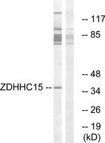 ZDHHC15 Antibody in Western Blot (WB)