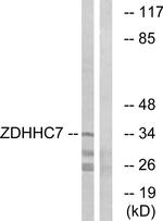ZDHHC7 Antibody in Western Blot (WB)