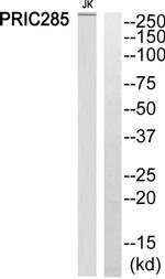 HELZ2 Antibody in Western Blot (WB)