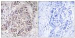 PEX1 Antibody in Immunohistochemistry (Paraffin) (IHC (P))