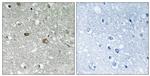 PIGH Antibody in Immunohistochemistry (Paraffin) (IHC (P))