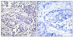PLCXD1 Antibody in Immunohistochemistry (Paraffin) (IHC (P))
