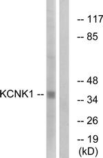 KCNK1 Antibody in Western Blot (WB)
