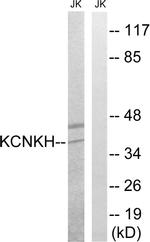 KCNK17 Antibody in Western Blot (WB)
