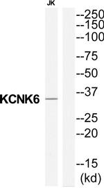 KCNK6 Antibody in Western Blot (WB)