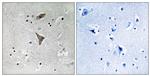 KCNT1 Antibody in Immunohistochemistry (Paraffin) (IHC (P))