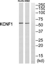 KCNF1 Antibody in Western Blot (WB)