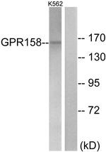 GPR158 Antibody in Western Blot (WB)