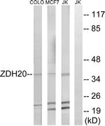 ZDHHC20 Antibody in Western Blot (WB)