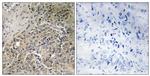 A26C2/A26C3 Antibody in Immunohistochemistry (Paraffin) (IHC (P))