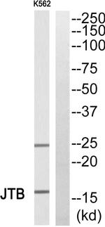 JTB Antibody in Western Blot (WB)