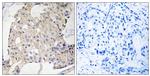 NDRG3 Antibody in Immunohistochemistry (Paraffin) (IHC (P))