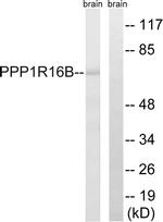 PPP1R16B Antibody in Western Blot (WB)