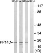 PPP1R14D Antibody in Western Blot (WB)