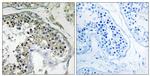 PPP1R1C Antibody in Immunohistochemistry (Paraffin) (IHC (P))