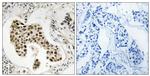 PMS2/PMS2CL Antibody in Immunohistochemistry (Paraffin) (IHC (P))