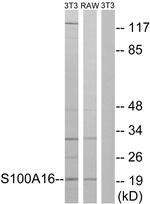 S100A16 Antibody in Western Blot (WB)