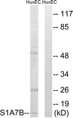 S100A7L2 Antibody in Western Blot (WB)
