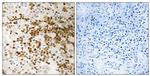 S100P Antibody in Immunohistochemistry (Paraffin) (IHC (P))