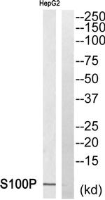 S100P Antibody in Western Blot (WB)